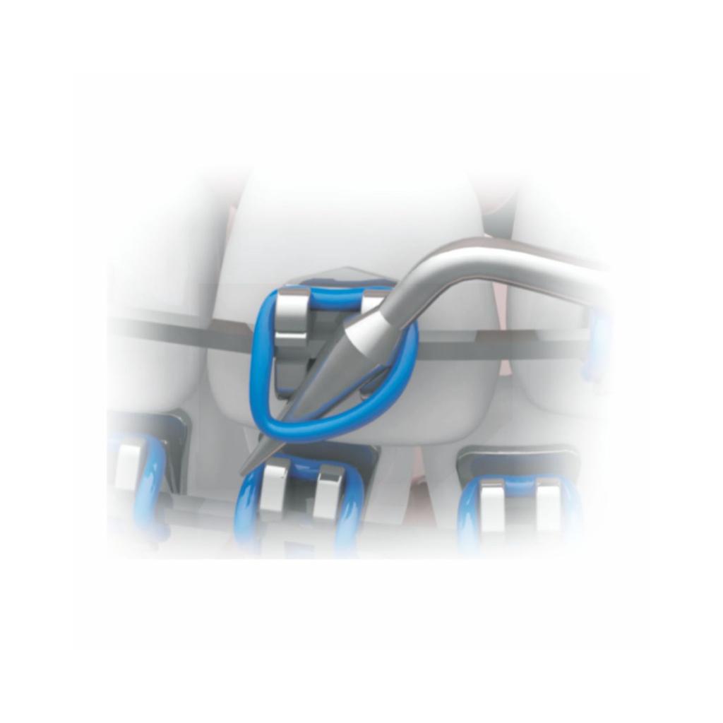 Elastic Ligature Applicator/Extractor - Plastic_3