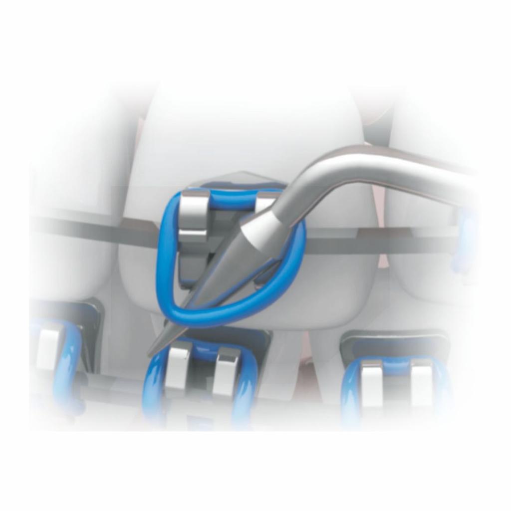 Elastic Ligature Applicator/Extractor - S. Steel_3