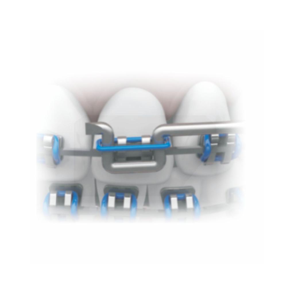 Elastic Ligature Applicator/Extractor - S. Steel_2